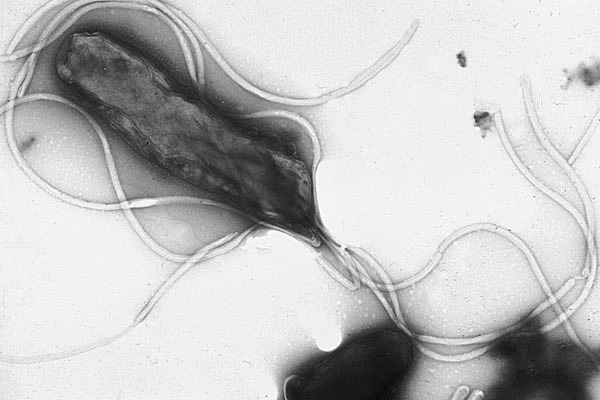 Elektronmikroskopbillede af bakterien Helicobacter pylori